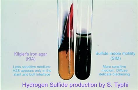 Hydrogen Sulfide Test – Principle, Procedure, Uses .